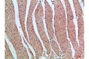 Immunohistochemical analysis of paraffin-embedded Human-colon, antibody was diluted at 1:100 (PIK3R2 Antikörper  (AA 1-60))