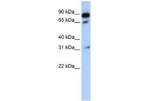 ABCD4 antibody used at 1 ug/ml to detect target protein. (ABCD4 Antikörper)