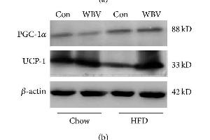 Protein expression of UCP1 and PGC-1α in WAT. (UCP1 Antikörper  (AA 101-200))