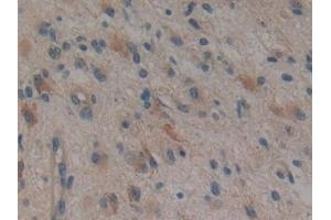 Immunohistochemistry (IHC) image for anti-Mps1 (TTK) (AA 532-786) antibody (ABIN7443260)