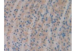 Immunohistochemistry (IHC) image for anti-serpin Peptidase Inhibitor, Clade A (Alpha-1 Antiproteinase, Antitrypsin), Member 6 (SERPINA6) (AA 267-390) antibody (ABIN7438400)
