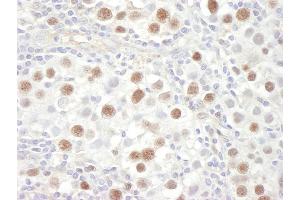 Immunohistochemistry (IHC) image for anti-Minichromosome Maintenance Deficient 4 (MCM4) (AA 325-375) antibody (ABIN7448653)