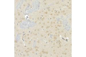 Immunohistochemistry of paraffin-embedded rat brain using CNTN4 Rabbit mAb (ABIN7266495) at dilution of 1:100 (40x lens). (Contactin 4 Antikörper)