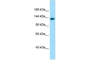 WB Suggested Anti-PPP1R9A Antibody Titration: 1. (PPP1R9A Antikörper  (C-Term))