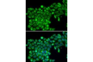Immunofluorescence analysis of MCF7 cell using TNFSF13 antibody. (TNFSF13 Antikörper  (AA 105-247))