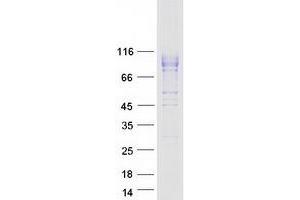 Western Blotting (WB) image for Interleukin 12 Receptor beta 1 (IL12RB1) (Transcript Variant 1) protein (Myc-DYKDDDDK Tag) (ABIN2713503)
