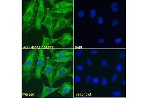 ABIN5539778 Immunofluorescence analysis of paraformaldehyde fixed HeLa cells, permeabilized with 0.