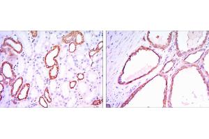 Immunohistochemical analysis of paraffin-embedded kidney tissues using HK1 mouse mAb with DAB staining. (Hexokinase 1 Antikörper)