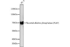 PLAP Antikörper