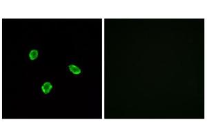 Immunofluorescence analysis of A549 cells, using SSTR1 antibody.