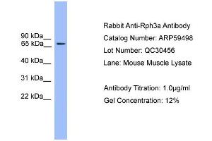 WB Suggested Anti-Rph3a  Antibody Titration: 0. (RPH3A Antikörper  (N-Term))