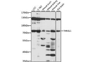 Western blot analysis of extracts of various cell lines, using THNSL1 antibody (ABIN7270815) at 1:1000 dilution. (THNSL1 Antikörper  (AA 534-743))
