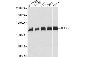 Western blot analysis of extracts of various cell lines, using ABI3BP antibody.