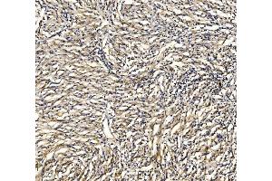 IHC analysis of GRID2 using anti-GRID2 antibody (ABIN7603172).