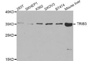 Western blot analysis of extracts of various cell lines, using TRIB3 antibody. (TRIB3 Antikörper)