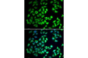 Immunofluorescence analysis of A549 cell using WDR77 antibody. (WDR77 Antikörper)