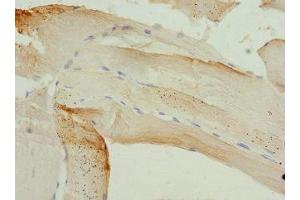 Immunohistochemistry of paraffin-embedded human skeletal muscle tissue using ABIN7163187 at dilution of 1:100 (PIP5K1B Antikörper  (AA 190-470))