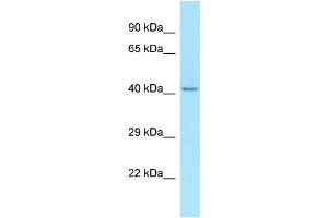 WB Suggested Anti-LIPK Antibody Titration: 1. (LIPK Antikörper  (N-Term))