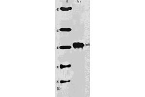 Western Blotting (WB) image for anti-DNA Repair Protein Homolog 1 (RAD51) antibody (ABIN2452093) (RAD51 Antikörper)