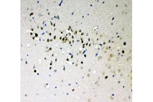 Anti-DDX5 antibody, IHC(P) IHC(P): Rat Brain Tissue (DDX5 Antikörper  (C-Term))
