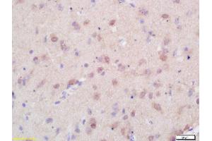 Formalin-fixed and paraffin embedded rat brain labeled with Rabbit Anti Menin/Men1 Polyclonal Antibody, Unconjugated (ABIN676343) at 1:200 followed by conjugation to the secondary antibody and DAB staining (Menin Antikörper  (AA 501-615))