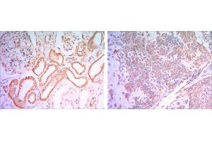 Immunohistochemical analysis of paraffin-embedded human salivary gland tissues (left) and kidney tissues (right) using HK1 antibody with DAB staining.