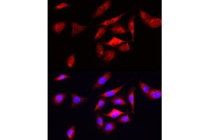 Immunofluorescence analysis of U2OS cells using ODC1 Rabbit pAb (ABIN3015743, ABIN3015744, ABIN3015745 and ABIN6219097) at dilution of 1:50 (40x lens). (ODC1 Antikörper  (AA 1-280))