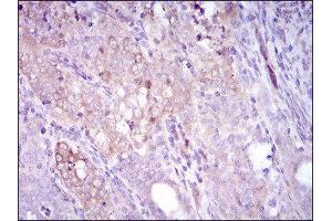 Immunohistochemistry (IHC) image for anti-Sequestosome 1 (SQSTM1) (AA 232-356) antibody (ABIN1846090) (SQSTM1 Antikörper  (AA 232-356))