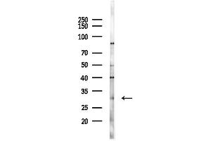 anti-Glutathione S-Transferase mu 3 (Brain) (GSTM3) (C-Term) antibody