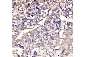 IHC analysis of IFIT5 using anti-IFIT5 antibody (ABIN7600752). (IFIT5 Antikörper  (AA 23-439))