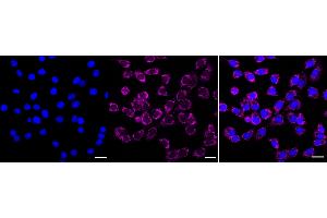 anti-Isocitrate Dehydrogenase 2 (NADP+), Mitochondrial (IDH2) antibody