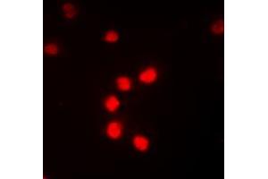 Immunofluorescent analysis of NF-kappaB p65 (pT435) staining in K562 cells.