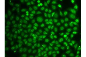 Immunofluorescence analysis of A549 cells using ZNF346 antibody (ABIN5971759). (ZNF346 Antikörper)