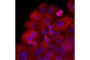 Immunofluorescence (IF) image for anti-Tubulin, beta 2B (TUBB2B) antibody (ABIN567630) (TUBB2B Antikörper)