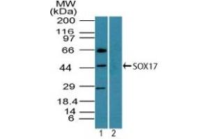 Image no. 1 for anti-SRY (Sex Determining Region Y)-Box 17 (SOX17) (AA 120-170) antibody (ABIN960351) (SOX17 Antikörper  (AA 120-170))