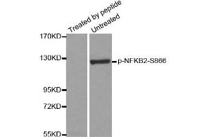 Western Blotting (WB) image for anti-Nuclear Factor of kappa Light Polypeptide Gene Enhancer in B-Cells 2 (NFKB2) (pSer866) antibody (ABIN1870473) (NFKB2 Antikörper  (pSer866))