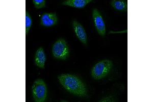 Immunofluorescence: This antibody stained HeLa cells. (CCL27 Antikörper)