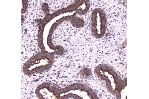 IHC analysis of 14-3-3 zeta/delta using anti-14-3-3 zeta/delta antibody . (14-3-3 zeta Antikörper)