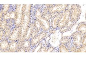 Detection of FIGN in Human Kidney Tissue using Polyclonal Antibody to Fidgetin (FIGN) (Fidgetin Antikörper  (AA 1-308))