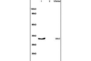 Lane 1: mouse embryo lysates Lane 2: mouse intestine lysates probed with Anti- EKLF/KLF1, 2, 4 Polyclonal Antibody, Unconjugated (ABIN1386255) at 1:200 in 4 °C. (KLF1/2/4 Antikörper  (AA 279-303))