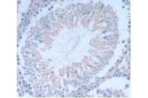 Immunohistochemistry (IHC) image for anti-Inhibin, beta A (INHBA) (AA 314-424) antibody (ABIN7426631)