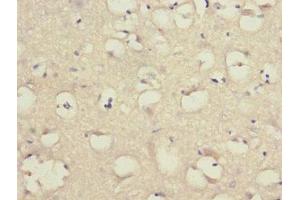 Immunohistochemistry of paraffin-embedded human brain tissue using ABIN7158053 at dilution of 1:100 (LINGO1 Antikörper  (AA 42-240))