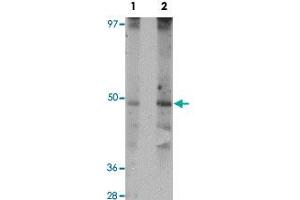 Western blot analysis of rat liver tissue with WDR74 polyclonal antibody  at (Lane 1) 1 and (Lane 2) 2 ug/mL dilution. (WDR74 Antikörper  (N-Term))