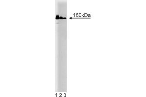 Western Blotting (WB) image for anti-MutS Homolog 6 (E. Coli) (MSH6) (AA 225-333) antibody (ABIN968248)