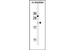 NAT14 Antikörper  (N-Term)