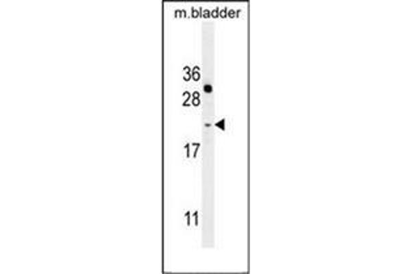 NAT14 Antikörper  (N-Term)