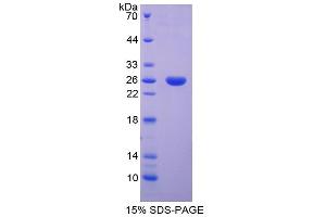 SDS-PAGE analysis of Rat SPB Protein. (SFTPB Protein)