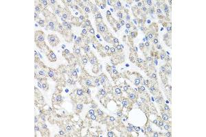 Immunohistochemistry of paraffin-embedded human liver injury using OTC antibody. (OTC Antikörper)