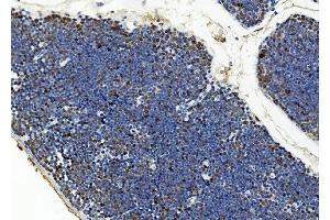 IHC analysis of BUB1 using anti-BUB1 antibody (ABIN7600942).
