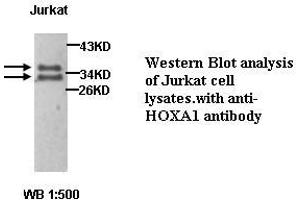 Image no. 1 for anti-Homeobox A1 (HOXA1) antibody (ABIN1577055) (HOXA1 Antikörper)